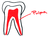 Zahnpulpa skizziert